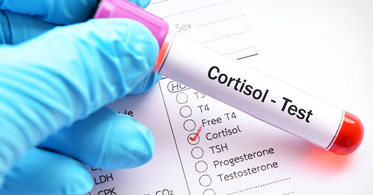 Joy Medical Blog - The Role Cortisol Plays In Weight Gain