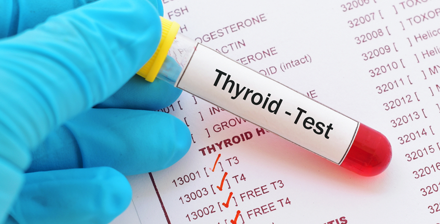 Complete Thyroid Testing